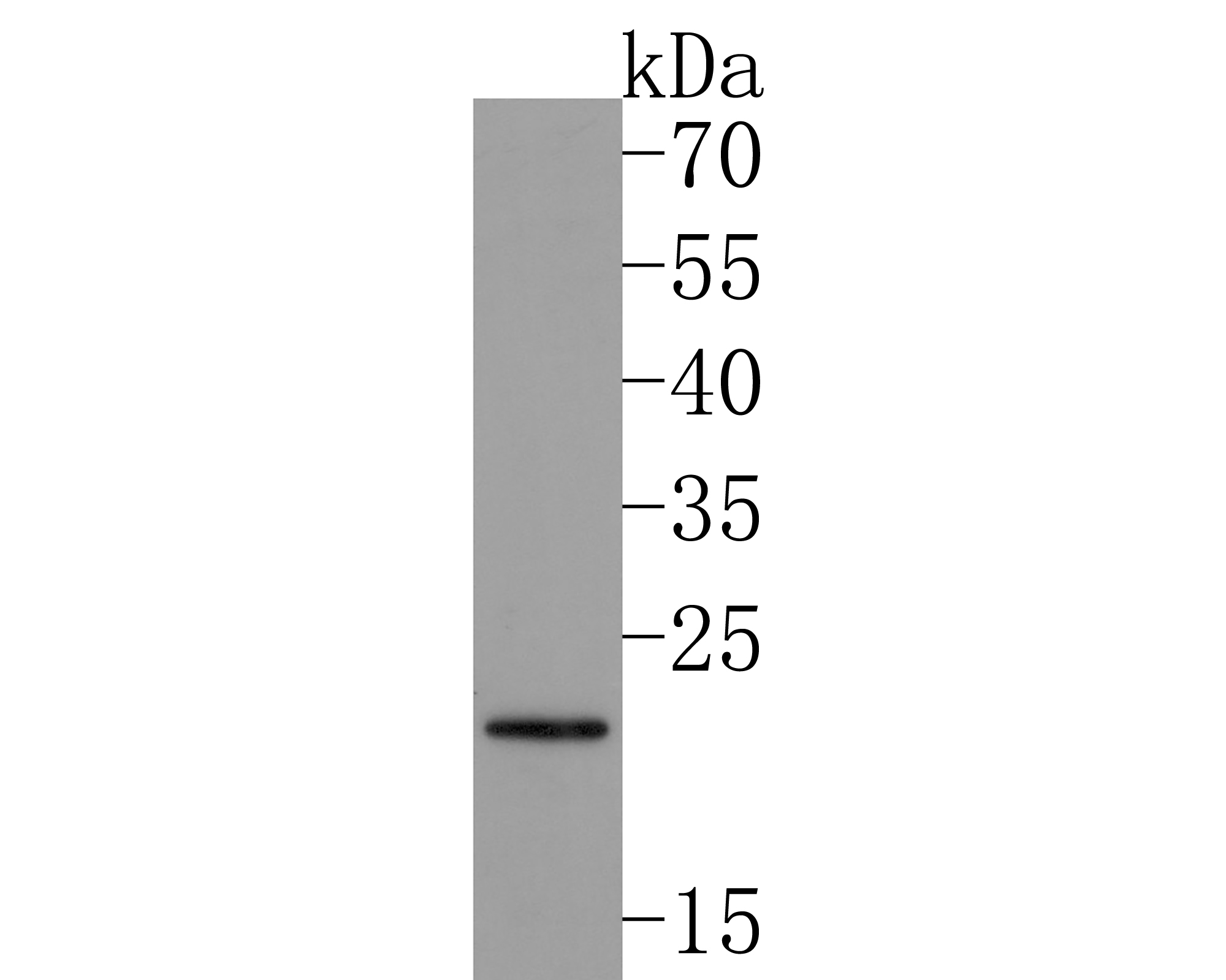 Western blot analysis of Lin28 on K562 cell lysates. Proteins were transferred to a PVDF membrane and blocked with 5% BSA in PBS for 1 hour at room temperature. The primary antibody (ET1704-26, 1/500) was used in 5% BSA at room temperature for 2 hours. Goat Anti-Rabbit IgG - HRP Secondary Antibody (HA1001) at 1:200,000 dilution was used for 1 hour at room temperature.<br />
<br />
Predicted band size: 23 kDa<br />
Observed band size: 25 kDa