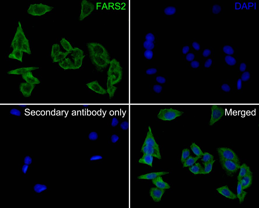ICC staining of FARS2 in SiHa cells (green). Formalin fixed cells were permeabilized with 0.1% Triton X-100 in TBS for 10 minutes at room temperature and blocked with 10% negative goat serum for 15 minutes at room temperature. Cells were probed with the primary antibody (HA500261, 1/50) for 1 hour at room temperature, washed with PBS. Alexa Fluor®488 conjugate-Goat anti-Rabbit IgG was used as the secondary antibody at 1/1,000 dilution. The nuclear counter stain is DAPI (blue).