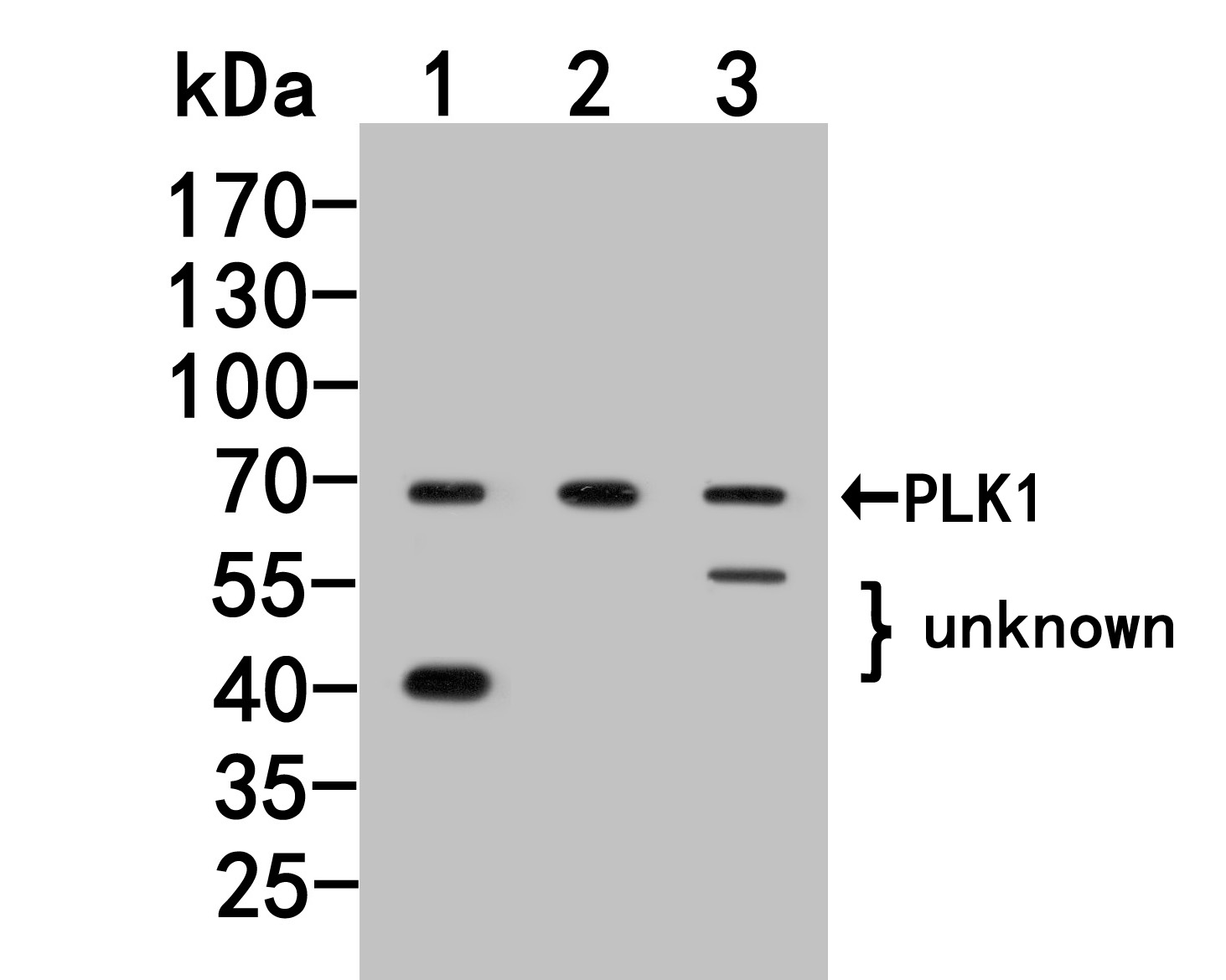 Western blot analysis of PLK1 on different lysates. Proteins were transferred to a PVDF membrane and blocked with 5% NFDM/TBST for 1 hour at room temperature. The primary antibody (HA500281, 1/1,000) was used in 5% NFDM/TBST at room temperature for 2 hours. Goat Anti-Rabbit IgG - HRP Secondary Antibody (HA1001) at 1:200,000 dilution was used for 1 hour at room temperature.<br />
Positive control: <br />
Lane 1: HepG2 cell lysate<br />
Lane 2: Hela cell lysate<br />
Lane 3: Mouse testis tissue lysate<br />
<br />
Predicted band size: 68 kDa<br />
Observed band size: 68/55/40 kDa