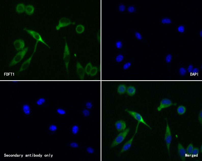 ICC staining of FDFT1 in SH-SY5Y cells (green). Formalin fixed cells were permeabilized with 0.1% Triton X-100 in TBS for 10 minutes at room temperature and blocked with 10% negative goat serum for 15 minutes at room temperature. Cells were probed with the primary antibody (HA720048, 1/50) for 1 hour at room temperature, washed with PBS. Alexa Fluor®488 conjugate-Goat anti-Rabbit IgG was used as the secondary antibody at 1/1,000 dilution. The nuclear counter stain is DAPI (blue).