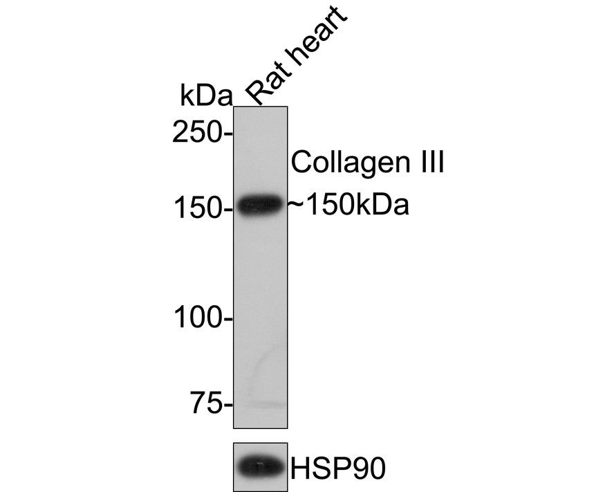 ICC staining of Collagen III in SiHa cells (green). Formalin fixed cells were permeabilized with 0.1% Triton X-100 in TBS for 10 minutes at room temperature and blocked with 10% negative goat serum for 15 minutes at room temperature. Cells were probed with the primary antibody (HA720050, 1/50) for 1 hour at room temperature, washed with PBS. Alexa Fluor®488 conjugate-Goat anti-Rabbit IgG was used as the secondary antibody at 1/1,000 dilution. The nuclear counter stain is DAPI (blue).