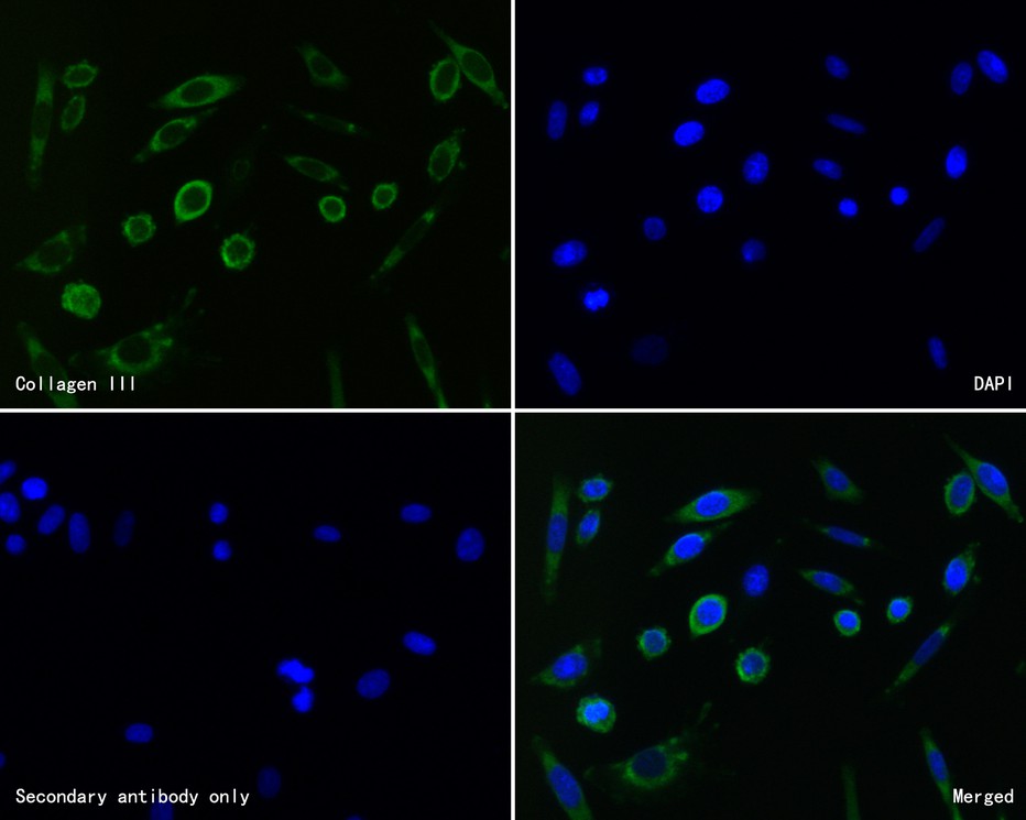 Flow cytometric analysis of Collagen III was done on Hela cells. The cells were fixed, permeabilized and stained with the primary antibody (HA720050, 1ug/ml) (red) compared with Rabbit IgG, monoclonal  - Isotype Control (green). After incubation of the primary antibody at +4℃ for 1 hour, the cells were stained with a Alexa Fluor®488 conjugate-Goat anti-Rabbit IgG Secondary antibody at 1/1,000 dilution for 30 minutes at +4℃ (dark incubation).Unlabelled sample was used as a control (cells without incubation with primary antibody; black).