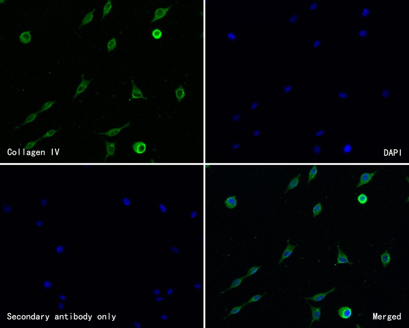 ICC staining of Collagen IV in SH-SY5Y cells (green). Methanol fixed cells were blocked with 10% negative goat serum for 15 minutes at room temperature. Cells were probed with the primary antibody (HA500197, 1/50) for 1 hour at room temperature, washed with PBS. Alexa Fluor®488 conjugate-Goat anti-Rabbit IgG was used as the secondary antibody at 1/1,000 dilution. The nuclear counter stain is DAPI (blue).