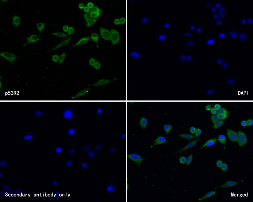 ICC staining of p53R2 in SH-SY5Y cells (green). Methanol fixed cells were blocked with 10% negative goat serum for 15 minutes at room temperature. Cells were probed with the primary antibody (HA500218, 1/50) for 1 hour at room temperature, washed with PBS. Alexa Fluor®488 conjugate-Goat anti-Rabbit IgG was used as the secondary antibody at 1/1,000 dilution. The nuclear counter stain is DAPI (blue).