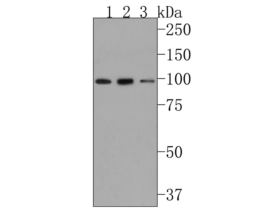 Western blot analysis of GCSF Receptor on different lysates with rabbit anti-GCSF Receptor antibody (HA500282) at 1/500 dilution.<br />
<br />
Lane 1: HL-60 cell lysate<br />
Lane 2: THP-1 cell lysate<br />
Lane 3: SH-SY5Y cell lysate<br />
<br />
Proteins were transferred to a PVDF membrane and blocked with 5% NFDM/TBST for 1 hour at room temperature. The primary antibody (HA500282, 1/500) was used in 5% NFDM/TBST at room temperature for 2 hours. Goat Anti-Rabbit IgG - HRP Secondary Antibody (HA1001) at 1:200,000 dilution was used for 1 hour at room temperature.<br />
<br />
Predicted band size: 92 kDa<br />
Observed band size: 92 kDa