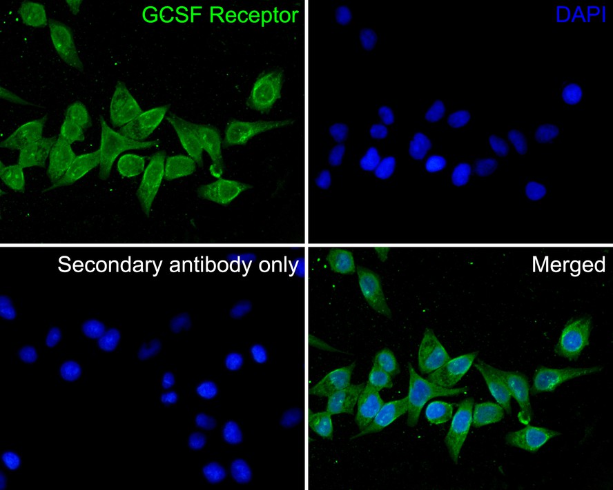 ICC staining of GCSF Receptor in Hela cells (green). Formalin fixed cells were permeabilized with 0.1% Triton X-100 in TBS for 10 minutes at room temperature and blocked with 10% negative goat serum for 15 minutes at room temperature. Cells were probed with the primary antibody (HA500282, 1/200) for 1 hour at room temperature, washed with PBS. Alexa Fluor®488 conjugate-Goat anti-Rabbit IgG was used as the secondary antibody at 1/1,000 dilution. The nuclear counter stain is DAPI (blue).