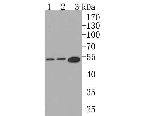 Western blot analysis of SOCS4 on different lysates. Proteins were transferred to a PVDF membrane and blocked with 5% NFDM/TBST for 1 hour at room temperature. The primary antibody (HA500307, 1/500) was used in 5% NFDM/TBST at room temperature for 2 hours. Goat Anti-Rabbit IgG - HRP Secondary Antibody (HA1001) at 1:200,000 dilution was used for 1 hour at room temperature.<br />
<br />
Positive control: <br />
Lane 1: Rat brain tissue lysate<br />
Lane 2: Mouse brain tissue lysate<br />
Lane 3: Mouse cerebellum tissue lysate<br />
<br />
Predicted band size: 51 kDa<br />
Observed band size: 51 kDa