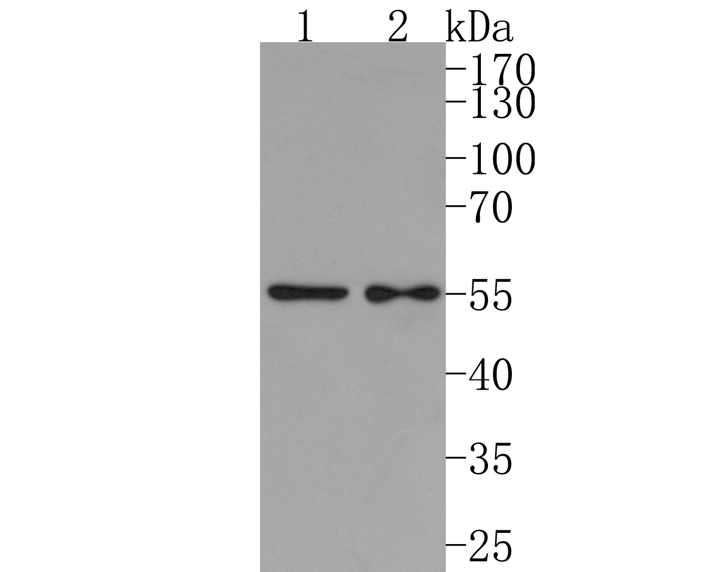 Western blot analysis of IL-5RA on different lysates. Proteins were transferred to a PVDF membrane and blocked with 5% NFDM/TBST in PBS for 1 hour at room temperature. The primary antibody (HA500303, 1/500) was used in 5% NFDM/TBST at room temperature for 2 hours. Goat Anti-Rabbit IgG - HRP Secondary Antibody (HA1001) at 1:200,000 dilution was used for 1 hour at room temperature.<br />
Positive control: <br />
Lane 1: Hela cell lysate<br />
Lane 2: PANC-1 cell lysate<br />
<br />
Predicted band size: 48 kDa<br />
Observed band size: 55 kDa (Glycosylation)