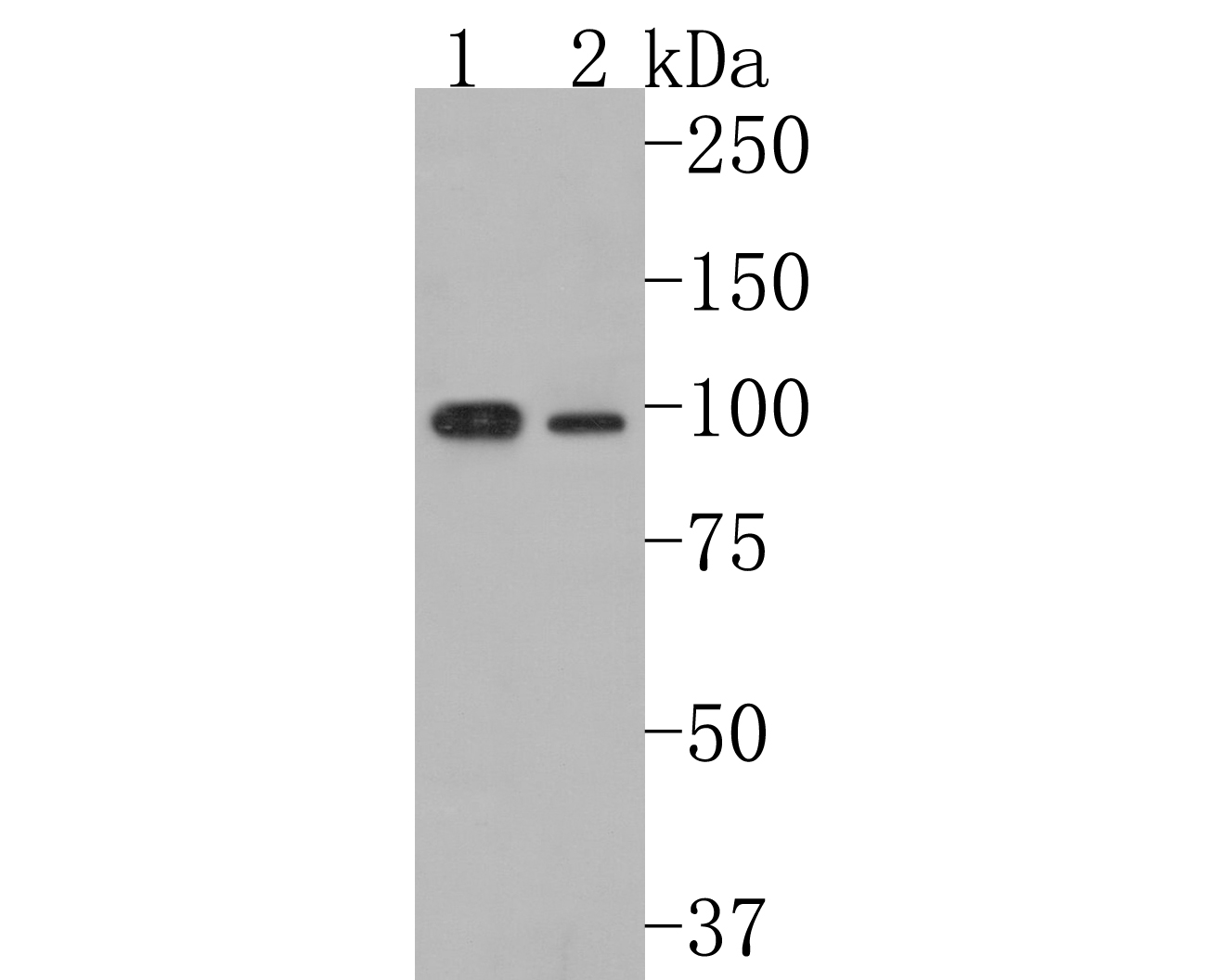 Western blot analysis of ClC2 on different lysates. Proteins were transferred to a PVDF membrane and blocked with 5% BSA in PBS for 1 hour at room temperature. The primary antibody (HA500243, 1/500) was used in 5% BSA at room temperature for 2 hours. Goat Anti-Rabbit IgG - HRP Secondary Antibody (HA1001) at 1:200,000 dilution was used for 1 hour at room temperature.<br />
Positive control: <br />
Lane 1: HepG2 cell lysate<br />
Lane 2: 293 cell lysate<br />
<br />
Predicted band size: 99 kDa<br />
Observed band size: 99 kDa