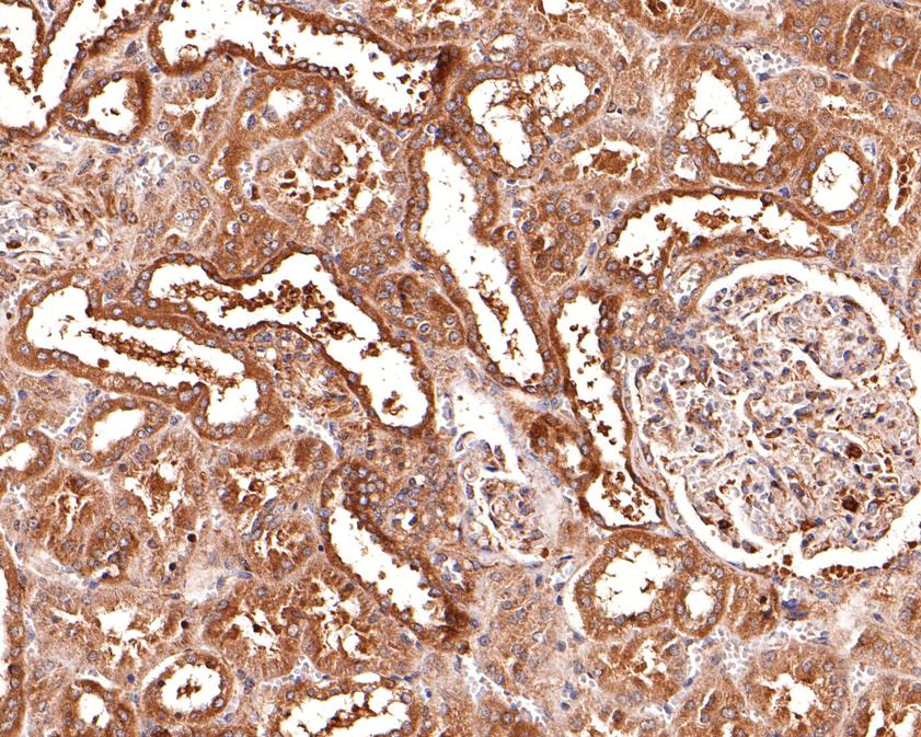 Immunohistochemical analysis of paraffin-embedded human kidney tissue using anti-ClC2 antibody. The section was pre-treated using heat mediated antigen retrieval with Tris-EDTA buffer (pH 9.0) for 20 minutes.The tissues were blocked in 1% BSA for 30 minutes at room temperature, washed with ddH2O and PBS, and then probed with the primary antibody (HA500243, 1/200) for 30 minutes at room temperature. The detection was performed using an HRP conjugated compact polymer system. DAB was used as the chromogen. Tissues were counterstained with hematoxylin and mounted with DPX.