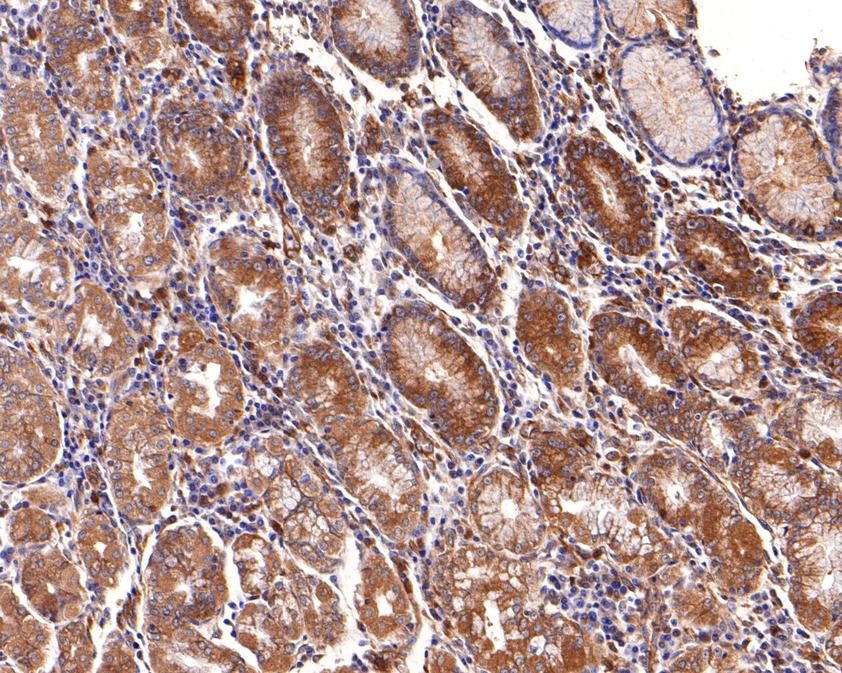 Immunohistochemical analysis of paraffin-embedded human stomach tissue using anti-ClC2 antibody. The section was pre-treated using heat mediated antigen retrieval with Tris-EDTA buffer (pH 9.0) for 20 minutes.The tissues were blocked in 1% BSA for 30 minutes at room temperature, washed with ddH2O and PBS, and then probed with the primary antibody (HA500243, 1/200) for 30 minutes at room temperature. The detection was performed using an HRP conjugated compact polymer system. DAB was used as the chromogen. Tissues were counterstained with hematoxylin and mounted with DPX.