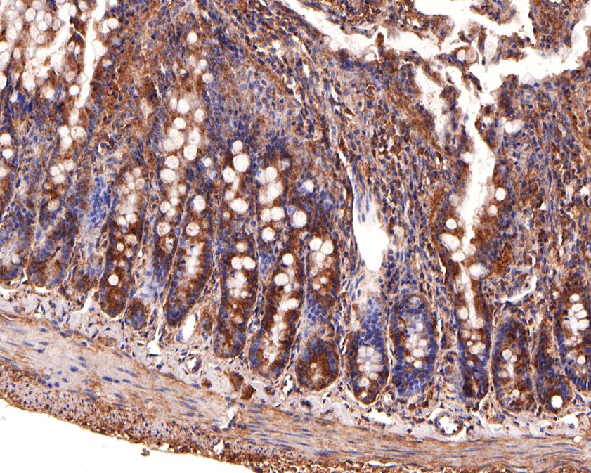 Immunohistochemical analysis of paraffin-embedded rat colon tissue using anti-ClC2 antibody. The section was pre-treated using heat mediated antigen retrieval with Tris-EDTA buffer (pH 9.0) for 20 minutes.The tissues were blocked in 1% BSA for 30 minutes at room temperature, washed with ddH2O and PBS, and then probed with the primary antibody (HA500243, 1/200) for 30 minutes at room temperature. The detection was performed using an HRP conjugated compact polymer system. DAB was used as the chromogen. Tissues were counterstained with hematoxylin and mounted with DPX.