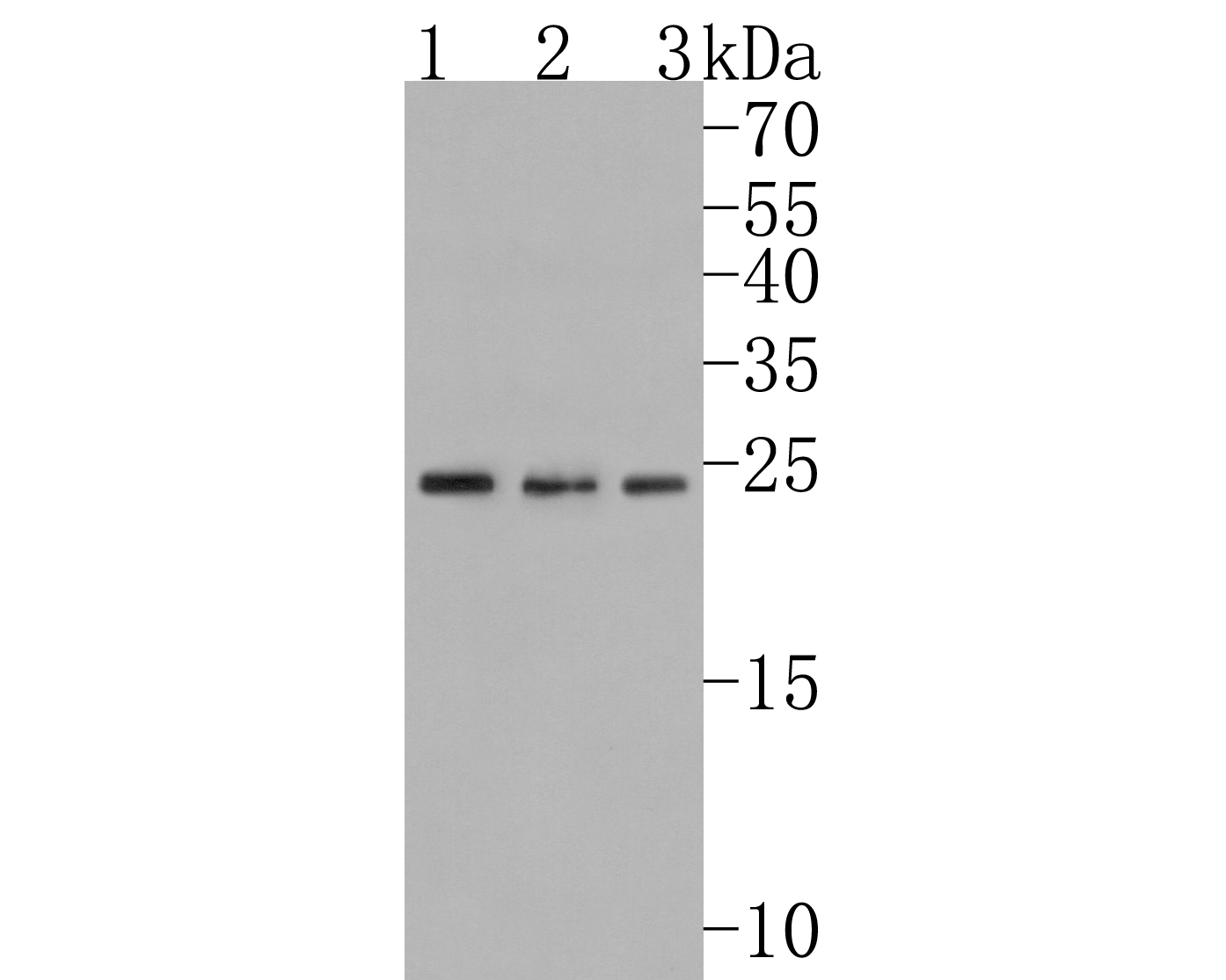 Western blot analysis of Gankyrin on different lysates. Proteins were transferred to a PVDF membrane and blocked with 5% BSA in PBS for 1 hour at room temperature. The primary antibody (HA500244, 1/500) was used in 5% BSA at room temperature for 2 hours. Goat Anti-Rabbit IgG - HRP Secondary Antibody (HA1001) at 1:200,000 dilution was used for 1 hour at room temperature.<br />
Positive control: <br />
Lane 1: A549 cell lysate<br />
Lane 2: Hela cell lysate<br />
Lane 2: 293T cell lysate<br />
<br />
Predicted band size: 24 kDa<br />
Observed band size: 24 kDa