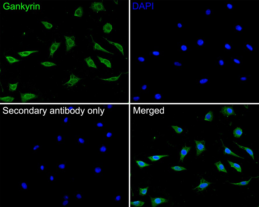 ICC staining of Gankyrin in SH-SY5Y cells (green). Formalin fixed cells were permeabilized with 0.1% Triton X-100 in TBS for 10 minutes at room temperature and blocked with 10% negative goat serum for 15 minutes at room temperature. Cells were probed with the primary antibody (HA500244, 1/200) for 1 hour at room temperature, washed with PBS. Alexa Fluor®488 conjugate-Goat anti-Rabbit IgG was used as the secondary antibody at 1/1,000 dilution. The nuclear counter stain is DAPI (blue).