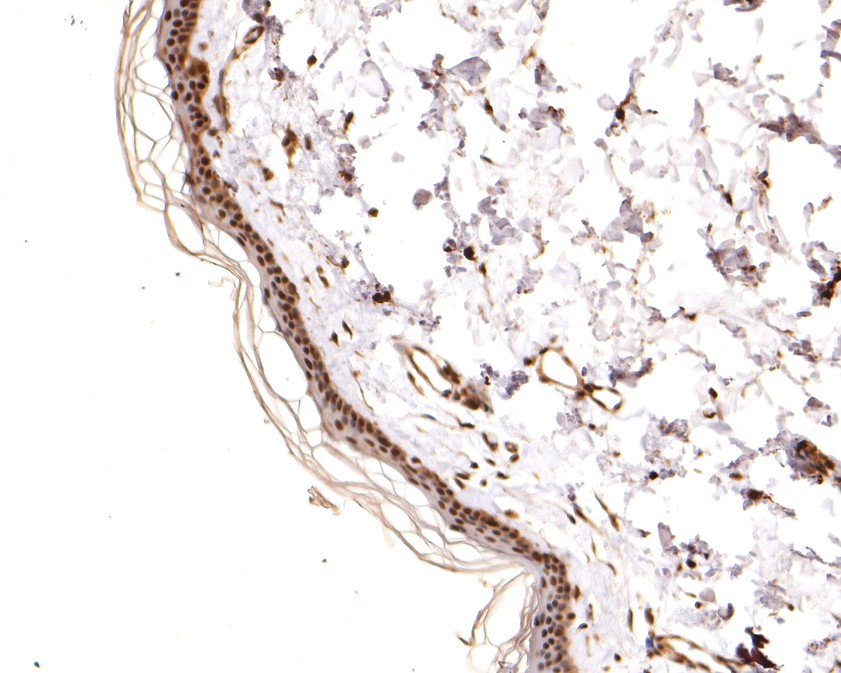 Immunohistochemical analysis of paraffin-embedded human skin tissue using anti-Gankyrin antibody. The section was pre-treated using heat mediated antigen retrieval with sodium citrate buffer (pH 6.0) for 20 minutes. The tissues were blocked in 1% BSA for 30 minutes at room temperature, washed with ddH2O and PBS, and then probed with the primary antibody (HA500244, 1/600)  for 30 minutes at room temperature. The detection was performed using an HRP conjugated compact polymer system. DAB was used as the chromogen. Tissues were counterstained with hematoxylin and mounted with DPX.