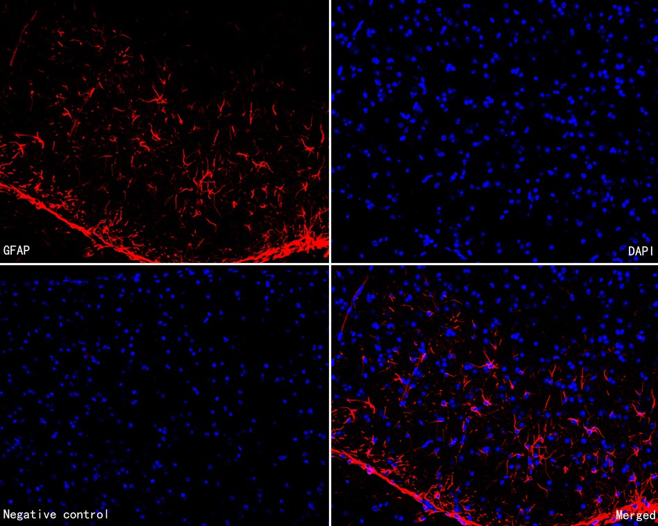 Immunofluorescence analysis of paraffin-embedded mouse brain tissue labeling GFAP with Mouse anti-GFAP antibody (HA600102F) at 1/200 dilution.<br />
<br />
The section was pre-treated using heat mediated antigen retrieval with Tris-EDTA buffer (pH 9.0) for 20 minutes. The tissues were blocked in 10% negative goat serum for 1 hour at room temperature, washed with PBS, and then incubated overnight with GFAP-iFluor™ 594 (HA600102F, red) at 1/200 dilution overnight at +4℃ , washed with PBS. Nuclear DNA was labelled in blue with DAPI.