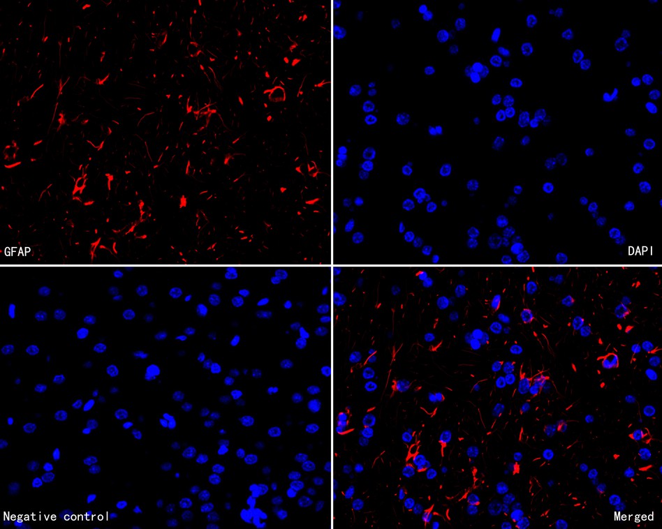 Immunofluorescence analysis of paraffin-embedded rat brain tissue labeling GFAP with Mouse anti-GFAP antibody (HA600102F) at 1/200 dilution.<br />
<br />
The section was pre-treated using heat mediated antigen retrieval with Tris-EDTA buffer (pH 9.0) for 20 minutes. The tissues were blocked in 10% negative goat serum for 1 hour at room temperature, washed with PBS, and then incubated overnight with GFAP-iFluor™ 594 (HA600102F, red) at 1/200 dilution overnight at +4℃ , washed with PBS. Nuclear DNA was labelled in blue with DAPI.