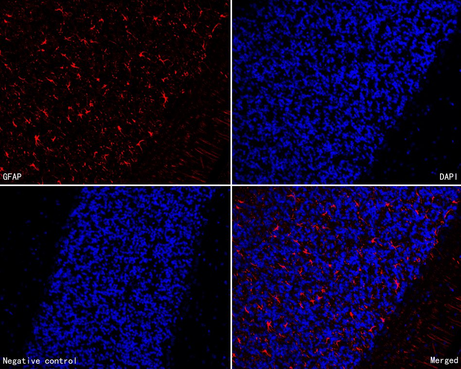 Immunofluorescence analysis of paraffin-embedded rat cerebellum tissue labeling GFAP with Mouse anti-GFAP antibody (HA600102F) at 1/200 dilution.<br />
<br />
The section was pre-treated using heat mediated antigen retrieval with Tris-EDTA buffer (pH 9.0) for 20 minutes. The tissues were blocked in 10% negative goat serum for 1 hour at room temperature, washed with PBS, and then incubated overnight with GFAP-iFluor™ 594 (HA600102F, red) at 1/200 dilution overnight at +4℃ , washed with PBS. Nuclear DNA was labelled in blue with DAPI.