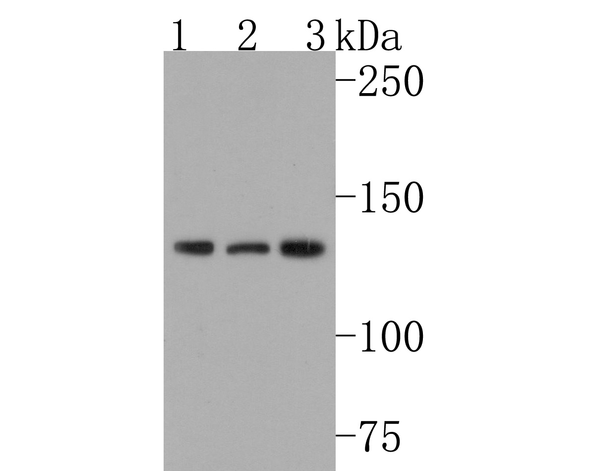 Western blot analysis of Bub1 on different lysates. Proteins were transferred to a PVDF membrane and blocked with 5% BSA in PBS for 1 hour at room temperature. The primary antibody (HA600053, 1/500) was used in 5% BSA at room temperature for 2 hours. Goat Anti-Mouse IgG - HRP Secondary Antibody (HA1006) at 1:20,000 dilution was used for 1 hour at room temperature.<br />
Positive control: <br />
Lane 1: Hela cell lysate<br />
Lane 2: K562 cell lysate<br />
Lane 3: 293T cell lysate