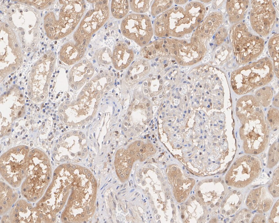 Immunohistochemical analysis of paraffin-embedded human kidney tissue with Mouse anti-eIF-6 antibody (HA600052) at 1/200 dilution.<br />
<br />
The section was pre-treated using heat mediated antigen retrieval with sodium citrate buffer (pH 6.0) for 2 minutes. The tissues were blocked in 1% BSA for 20 minutes at room temperature, washed with ddH2O and PBS, and then probed with the primary antibody (HA600052) at 1/200 dilution for 1 hour at room temperature. The detection was performed using an HRP conjugated compact polymer system. DAB was used as the chromogen. Tissues were counterstained with hematoxylin and mounted with DPX.