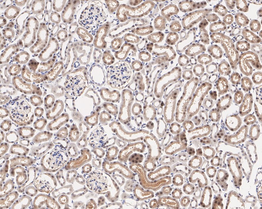 Immunohistochemical analysis of paraffin-embedded mouse kidney tissue with Mouse anti-eIF-6 antibody (HA600052) at 1/50 dilution.<br />
<br />
The section was pre-treated using heat mediated antigen retrieval with sodium citrate buffer (pH 6.0) for 2 minutes. The tissues were blocked in 1% BSA for 20 minutes at room temperature, washed with ddH2O and PBS, and then probed with the primary antibody (HA600052) at 1/50 dilution for 1 hour at room temperature. The detection was performed using an HRP conjugated compact polymer system. DAB was used as the chromogen. Tissues were counterstained with hematoxylin and mounted with DPX.