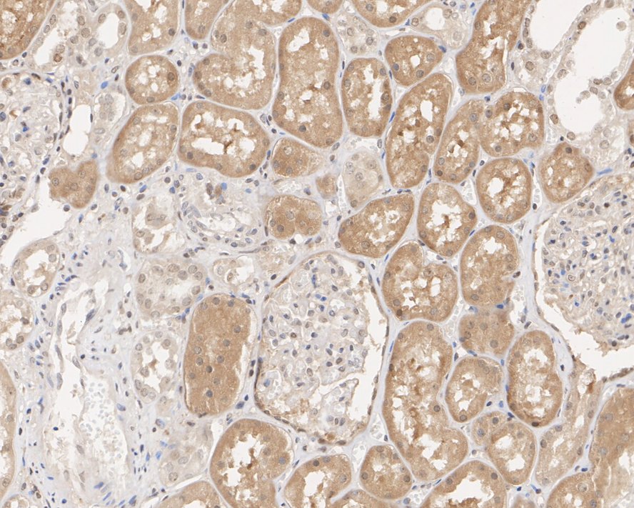 Immunohistochemical analysis of paraffin-embedded human esophagus tissue using anti-eIF-6 antibody. The section was pre-treated using heat mediated antigen retrieval with sodium citrate buffer (pH 6.0) for 20 minutes. The tissues were blocked in 1% BSA for 30 minutes at room temperature, washed with ddH2O and PBS, and then probed with the primary antibody (HA600051, 1/600)  for 30 minutes at room temperature. The detection was performed using an HRP conjugated compact polymer system. DAB was used as the chromogen. Tissues were counterstained with hematoxylin and mounted with DPX.
