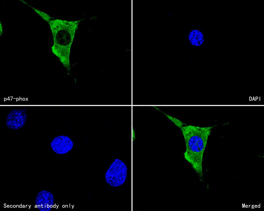 ICC staining of p47-phox in Hela cells (green). Formalin fixed cells were permeabilized with 0.1% Triton X-100 in TBS for 10 minutes at room temperature and blocked with 10% negative goat serum for 15 minutes at room temperature. Cells were probed with the primary antibody (HA600049, 1/100) for 1 hour at room temperature, washed with PBS. Alexa Fluor®488 conjugate-Goat anti-Mouse IgG was used as the secondary antibody at 1/1,000 dilution. The nuclear counter stain is DAPI (blue).