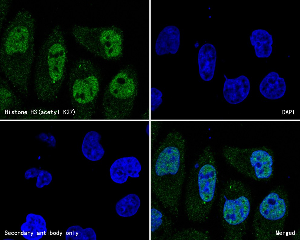 ICC staining of Histone H3 (acetyl K27) in Hela cells (green). Formalin fixed cells were permeabilized with 0.1% Triton X-100 in TBS for 10 minutes at room temperature and blocked with 10% negative goat serum for 15 minutes at room temperature. Cells were probed with the primary antibody (HA600047, 1/100) for 1 hour at room temperature, washed with PBS. Alexa Fluor®488 conjugate-Goat anti-Mouse IgG was used as the secondary antibody at 1/1,000 dilution. The nuclear counter stain is DAPI (blue).