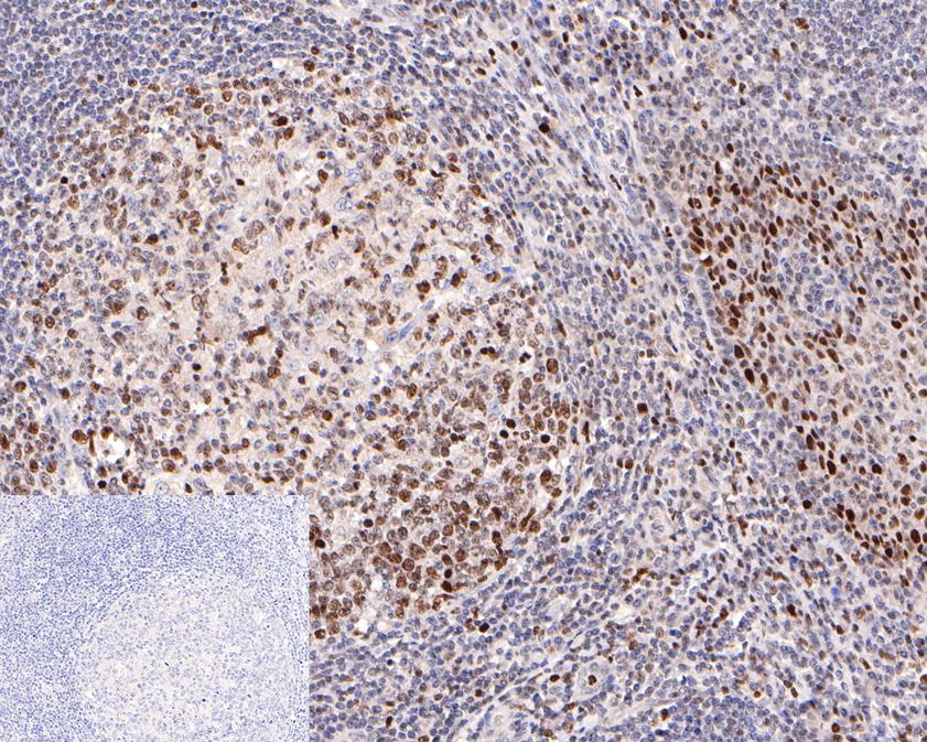 Immunohistochemical analysis of paraffin-embedded human tonsil tissue using anti-Histone H3 (acetyl K27) antibody. The section was pre-treated using heat mediated antigen retrieval with sodium citrate buffer (pH 6.0) for 20 minutes. The tissues were blocked in 1% BSA for 30 minutes at room temperature, washed with ddH2O and PBS, and then probed with the primary antibody (HA600047, 1/600)  for 30 minutes at room temperature. The detection was performed using an HRP conjugated compact polymer system. DAB was used as the chromogen. Tissues were counterstained with hematoxylin and mounted with DPX.