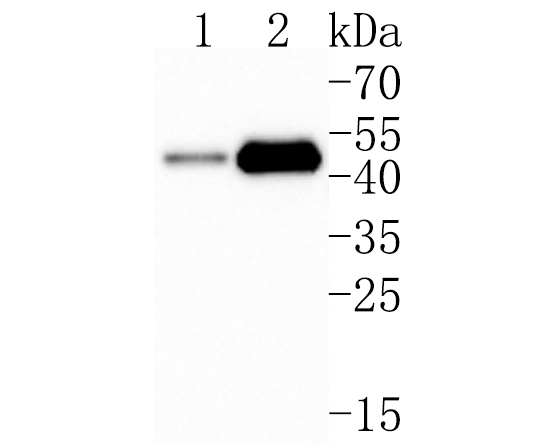 Western blot analysis of Galactosidase alpha on different lysates. Proteins were transferred to a PVDF membrane and blocked with 5% BSA in PBS for 1 hour at room temperature. The primary antibody (HA500245, 1/500) was used in 5% BSA at room temperature for 2 hours. Goat Anti-Rabbit IgG - HRP Secondary Antibody (HA1001) at 1:200,000 dilution was used for 1 hour at room temperature.<br />
Positive control: <br />
Lane 1: 293T cell lysate<br />
Lane 2: MCF-7 cell lysate<br />
<br />
Predicted band size: 49 kDa<br />
Observed band size: 49 kDa