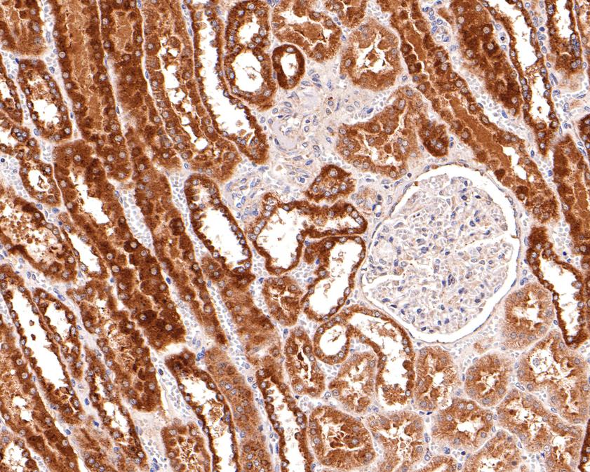 Immunohistochemical analysis of paraffin-embedded human kidney tissue using anti-Galactosidase alpha antibody. The section was pre-treated using heat mediated antigen retrieval with Tris-EDTA buffer (pH 9.0) for 20 minutes.The tissues were blocked in 1% BSA for 30 minutes at room temperature, washed with ddH2O and PBS, and then probed with the primary antibody (HA500245, 1/600) for 30 minutes at room temperature. The detection was performed using an HRP conjugated compact polymer system. DAB was used as the chromogen. Tissues were counterstained with hematoxylin and mounted with DPX.