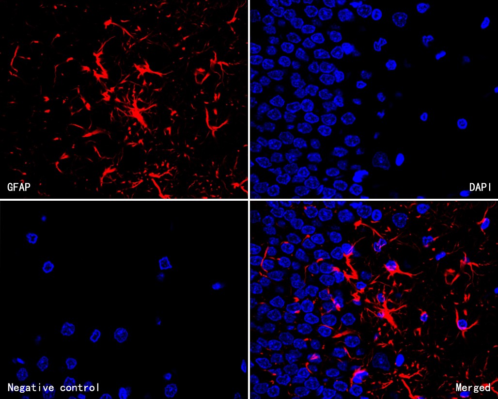 Immunofluorescence analysis of paraffin-embedded rat brain tissue labeling GFAP with Mouse anti-GFAP antibody (HA600103F) at 1/100 dilution.<br />
<br />
The section was pre-treated using heat mediated antigen retrieval with Tris-EDTA buffer (pH 9.0) for 20 minutes. The tissues were blocked in 10% negative goat serum for 1 hour at room temperature, washed with PBS, and then incubated overnight with GFAP-iFluor™ 647 (HA600103F, red) at 1/100 dilution overnight at +4℃, washed with PBS. Nuclear DNA was labelled in blue with DAPI.