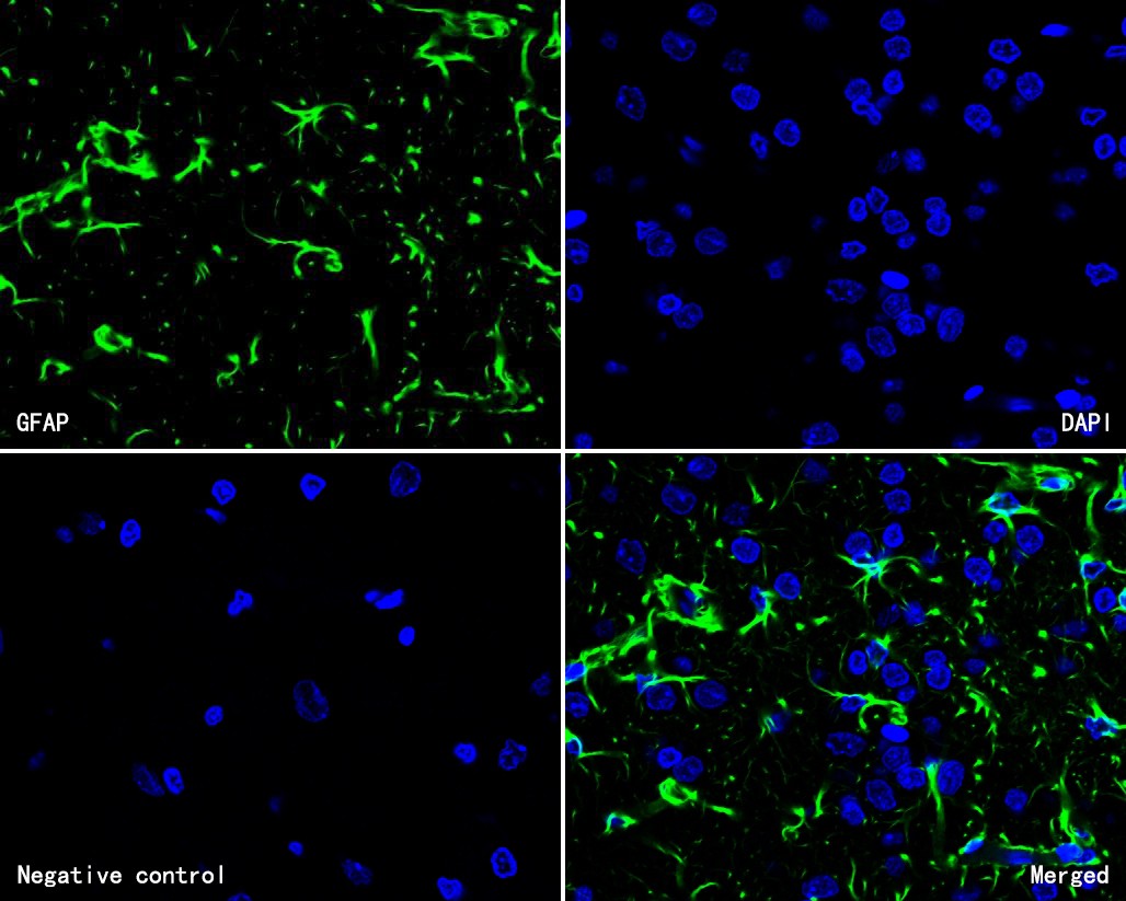 Immunofluorescence analysis of paraffin-embedded rat brain tissue labeling GFAP with Mouse anti-GFAP antibody (HA600101F) at 1/100 dilution.<br />
<br />
The section was pre-treated using heat mediated antigen retrieval with Tris-EDTA buffer (pH 9.0) for 20 minutes. The tissues were blocked in 10% negative goat serum for 1 hour at room temperature, washed with PBS, and then incubated overnight with GFAP-iFluor™ 488 (HA600101F, green) at 1/100 dilution overnight at +4℃ , washed with PBS. Nuclear DNA was labelled in blue with DAPI.