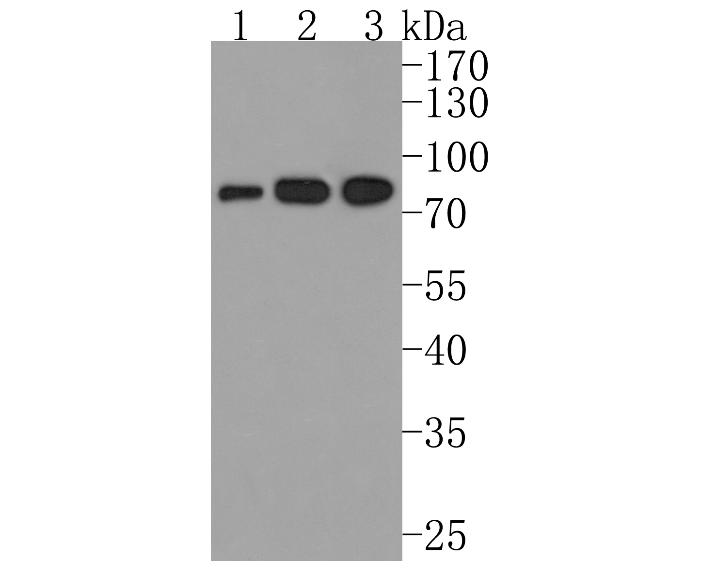 Western blot analysis of IL-21R on different lysates with rabbit anti-IL-21R antibody (HA500290) at 1/500 dilution.<br />
<br />
Lane 1: Rat spleen tissue lysate<br />
Lane 2: Rat liver tissue lysate<br />
Lane 3: Rat thymus tissue lysate<br />
<br />
Lysates/proteins at 10 µg per lane.<br />
<br />
Proteins were transferred to a PVDF membrane and blocked with 5% NFDM/TBST for 1 hour at room temperature. The primary antibody (HA500290, 1/500) was used in 5% NFDM/TBST at room temperature for 2 hours. Goat Anti-Rabbit IgG - HRP Secondary Antibody (HA1001) at 1:200,000 dilution was used for 1 hour at room temperature.<br />
<br />
Predicted band size: 59 kDa<br />
Observed band size: 80 kDa (Glycosylation)