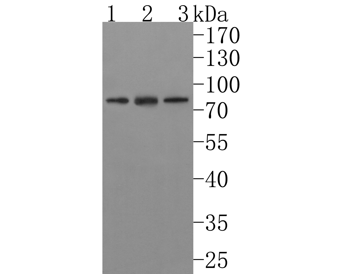 Western blot analysis of IL-21R on different lysates with rabbit anti-IL-21R antibody (HA500290) at 1/500 dilution.<br />
<br />
Lane 1: Mouse spleen tissue lysate<br />
Lane 2: Mouse thymus tissue lysate<br />
Lane 3: Daudi cell lysate<br />
<br />
Lysates/proteins at 10 µg per lane.<br />
<br />
Proteins were transferred to a PVDF membrane and blocked with 5% NFDM/TBST for 1 hour at room temperature. The primary antibody (HA500290, 1/500) was used in 5% NFDM/TBST at room temperature for 2 hours. Goat Anti-Rabbit IgG - HRP Secondary Antibody (HA1001) at 1:200,000 dilution was used for 1 hour at room temperature.<br />
<br />
Predicted band size: 59 kDa<br />
Observed band size: 80 kDa (Glycosylation)