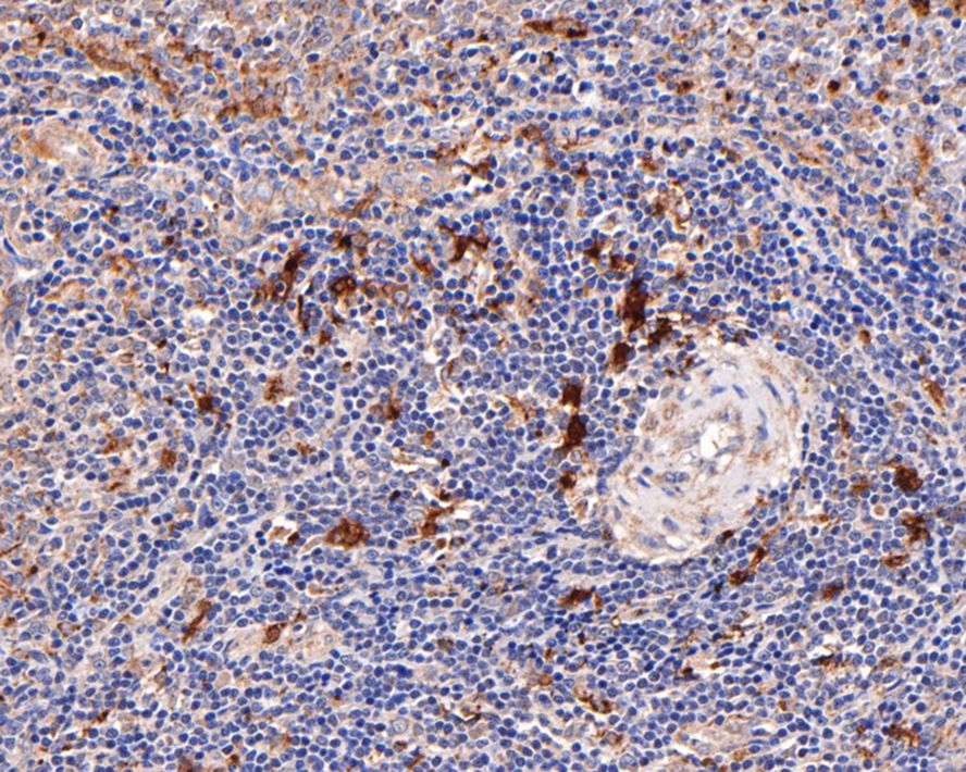 Immunohistochemical analysis of paraffin-embedded human spleen tissue using anti-CD45 antibody. The section was pre-treated using heat mediated antigen retrieval with Tris-EDTA buffer (pH 9.0) for 20 minutes.The tissues were blocked in 5% BSA for 30 minutes at room temperature, washed with ddH2O and PBS, and then probed with the primary antibody (HA500290, 1/600) for 30 minutes at room temperature. The detection was performed using an HRP conjugated compact polymer system. DAB was used as the chromogen. Tissues were counterstained with hematoxylin and mounted with DPX.