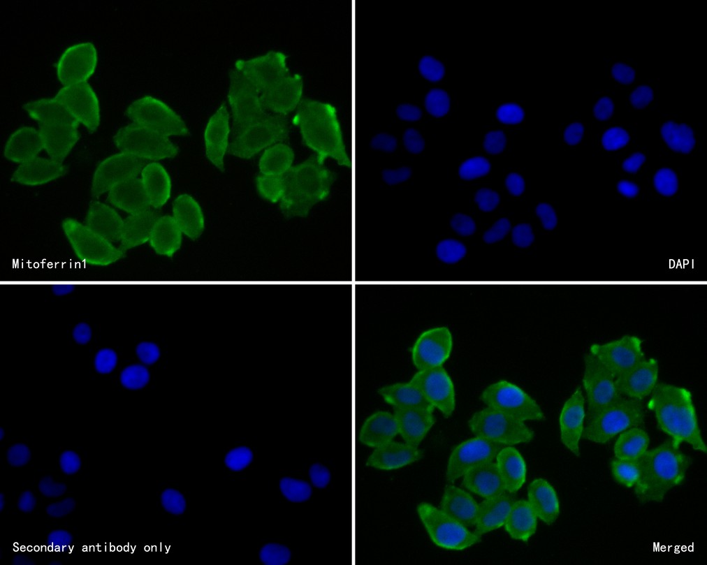 ICC staining of Mitoferrin1 in Hela cells (green). Formalin fixed cells were permeabilized with 0.1% Triton X-100 in TBS for 10 minutes at room temperature and blocked with 10% negative goat serum for 15 minutes at room temperature. Cells were probed with the primary antibody (HA500278, 1/50) for 1 hour at room temperature, washed with PBS. Alexa Fluor®488 conjugate-Goat anti-Rabbit IgG was used as the secondary antibody at 1/1,000 dilution. The nuclear counter stain is DAPI (blue).