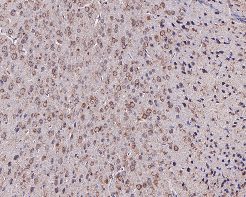 Immunohistochemical analysis of paraffin-embedded mouse brain tissue using anti-Mitoferrin1 antibody. The section was pre-treated using heat mediated antigen retrieval with Tris-EDTA buffer (pH 9.0) for 20 minutes.The tissues were blocked in 1% BSA for 30 minutes at room temperature, washed with ddH2O and PBS, and then probed with the primary antibody (HA500278, 1/400) for 30 minutes at room temperature. The detection was performed using an HRP conjugated compact polymer system. DAB was used as the chromogen. Tissues were counterstained with hematoxylin and mounted with DPX.