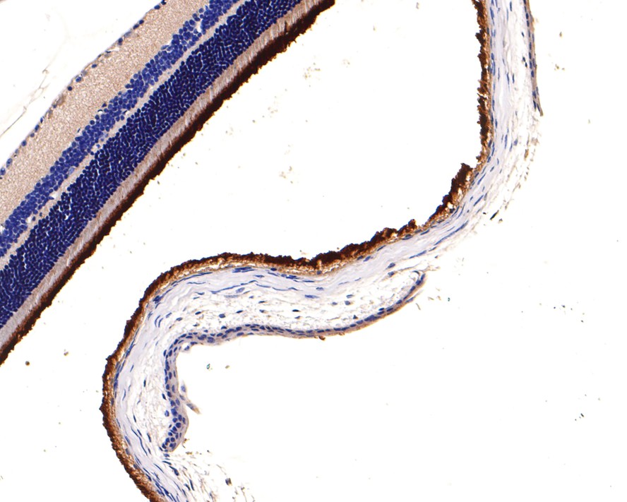 Immunohistochemical analysis of paraffin-embedded mouse eyeball tissue using anti-PDE6 alpha antibody. The section was pre-treated using heat mediated antigen retrieval with Tris-EDTA buffer (pH 9.0) for 20 minutes.The tissues were blocked in 1% BSA for 30 minutes at room temperature, washed with ddH2O and PBS, and then probed with the primary antibody (HA500264, 1/600) for 30 minutes at room temperature. The detection was performed using an HRP conjugated compact polymer system. DAB was used as the chromogen. Tissues were counterstained with hematoxylin and mounted with DPX.