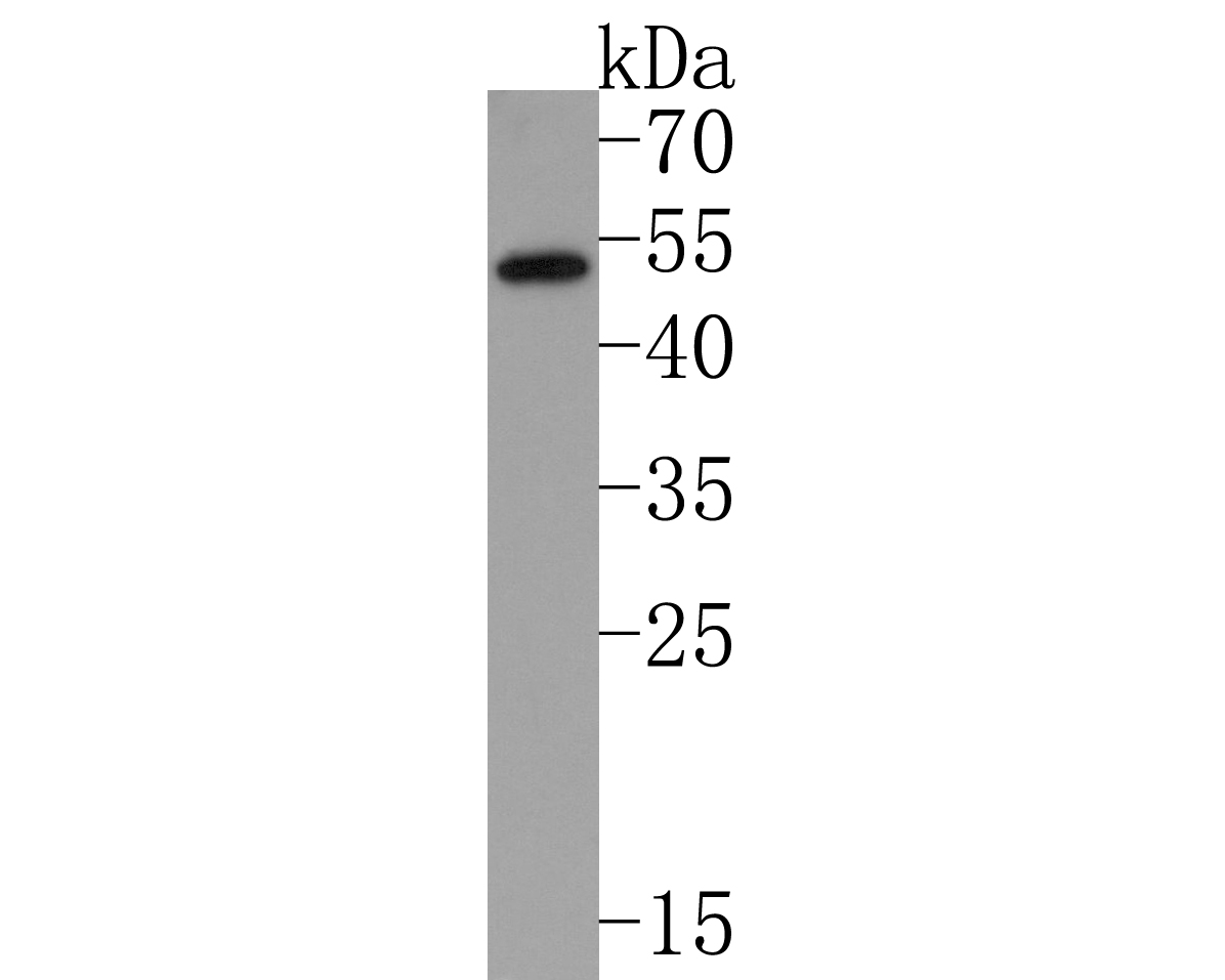 Western blot analysis of IL-2RG on different lysates with Rabbit/Mouse anti-IL-2RG antibody (HA500269) at 1/1,000 dilution.<br />
<br />
Lane 1: Mouse spleen tissue lysate<br />
Lane 2: Rat thymus tissue lysate<br />
<br />
Lysates/proteins at 20 µg/Lane.<br />
<br />
Predicted band size: 42 kDa<br />
Observed band size: 55 kDa (Glycoprotein)<br />
<br />
Exposure time: 3 minutes;<br />
<br />
12% SDS-PAGE gel.<br />
<br />
Proteins were transferred to a PVDF membrane and blocked with 5% NFDM/TBST for 1 hour at room temperature. The primary antibody (HA500269) at 1/1,000 dilution was used in 5% NFDM/TBST at room temperature for 2 hours. Goat Anti-Rabbit IgG - HRP Secondary Antibody (HA1001) at 1:100,000 dilution was used for 1 hour at room temperature.
