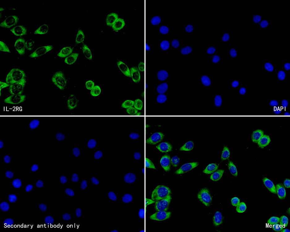 Immunocytochemistry analysis of SH-SY5Y cells labeling IL-2RG with with Rabbit anti-IL-2RG antibody (HA500269) at 1/200 dilution.<br />
<br />
Cells were fixed in 4% paraformaldehyde for 30minutes, permeabilized with 0.01% Triton X-100 in PBS for 15 minutes, and then blocked with 2% BSA for 30 minutes at room temperature. Cells were then incubated with Rabbit anti-IL-2RG antibody (HA500269) at 1/200 dilution in 2% BSA overnight at 4 ℃. Alexa Fluor®488 conjugate-Goat anti-Rabbit IgG was used as the secondary antibody at 1/1,000 dilution. Nuclear DNA was labelled in blue with DAPI.
