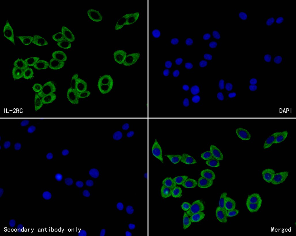Immunocytochemistry analysis of SiHa cells labeling IL-2RG with with Rabbit anti-IL-2RG antibody (HA500269) at 1/200 dilution.<br />
<br />
Cells were fixed in 4% paraformaldehyde for 30minutes, permeabilized with 0.01% Triton X-100 in PBS for 15 minutes, and then blocked with 2% BSA for 30 minutes at room temperature. Cells were then incubated with Rabbit anti-IL-2RG antibody (HA500269) at 1/200 dilution in 2% BSA overnight at 4 ℃. Alexa Fluor®488 conjugate-Goat anti-Rabbit IgG was used as the secondary antibody at 1/1,000 dilution. Nuclear DNA was labelled in blue with DAPI.