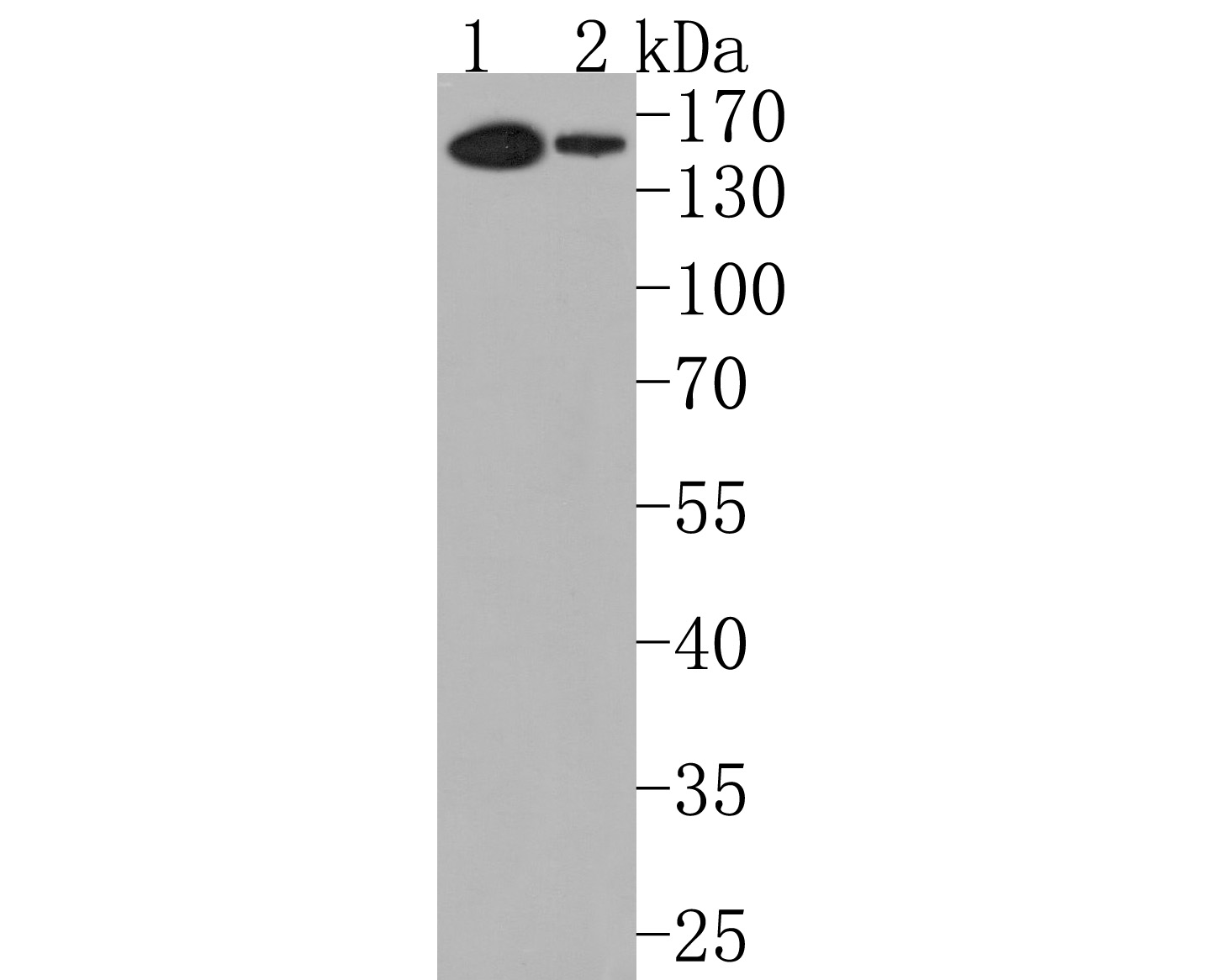 Western blot analysis of REST on different lysates. Proteins were transferred to a PVDF membrane and blocked with 5% BSA in PBS for 1 hour at room temperature. The primary antibody (HA720081, 1/500) was used in 5% BSA at room temperature for 2 hours. Goat Anti-Rabbit IgG - HRP Secondary Antibody (HA1001) at 1:200,000 dilution was used for 1 hour at room temperature.<br />
Positive control: <br />
Lane 1: HL-60 cell lysate<br />
Lane 2: HUVEC cell lysate<br />
<br />
Predicted band size: 122 kDa<br />
Observed band size: 150 kDa