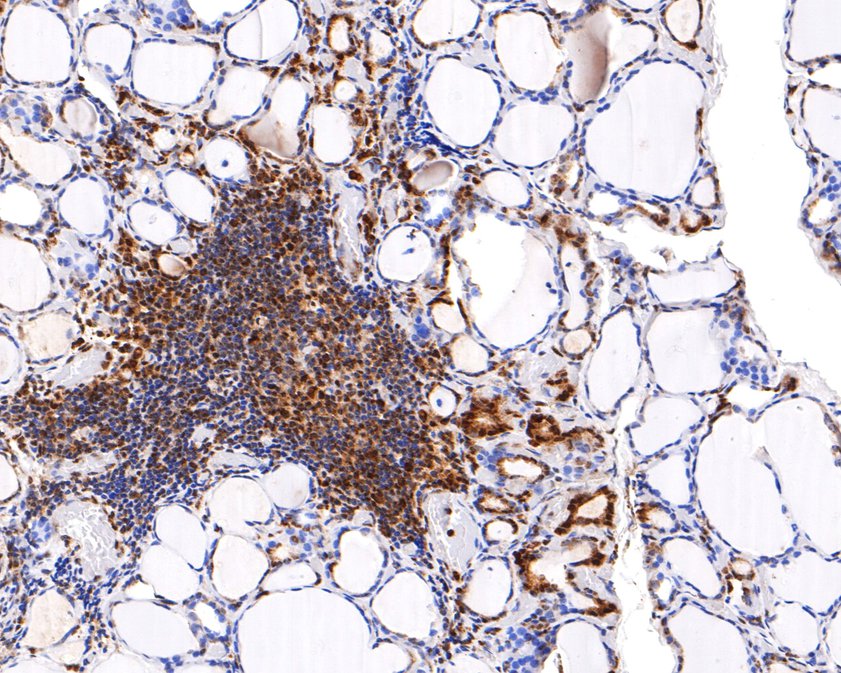 Immunohistochemical analysis of paraffin-embedded human thyroid tissue using anti-REST antibody. The section was pre-treated using heat mediated antigen retrieval with sodium citrate buffer (pH 6.0) for 20 minutes. The tissues were blocked in 1% BSA for 30 minutes at room temperature, washed with ddH2O and PBS, and then probed with the primary antibody (HA720081, 1/400)  for 30 minutes at room temperature. The detection was performed using an HRP conjugated compact polymer system. DAB was used as the chromogen. Tissues were counterstained with hematoxylin and mounted with DPX.