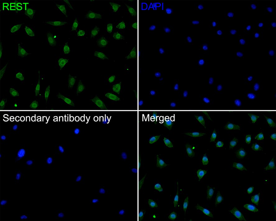 ICC staining of REST in SH-SY5Y cells (green). Formalin fixed cells were permeabilized with 0.1% Triton X-100 in TBS for 10 minutes at room temperature and blocked with 10% negative goat serum for 15 minutes at room temperature. Cells were probed with the primary antibody (HA720081, 1/200) for 1 hour at room temperature, washed with PBS. Alexa Fluor®488 conjugate-Goat anti-Rabbit IgG was used as the secondary antibody at 1/1,000 dilution. The nuclear counter stain is DAPI (blue).