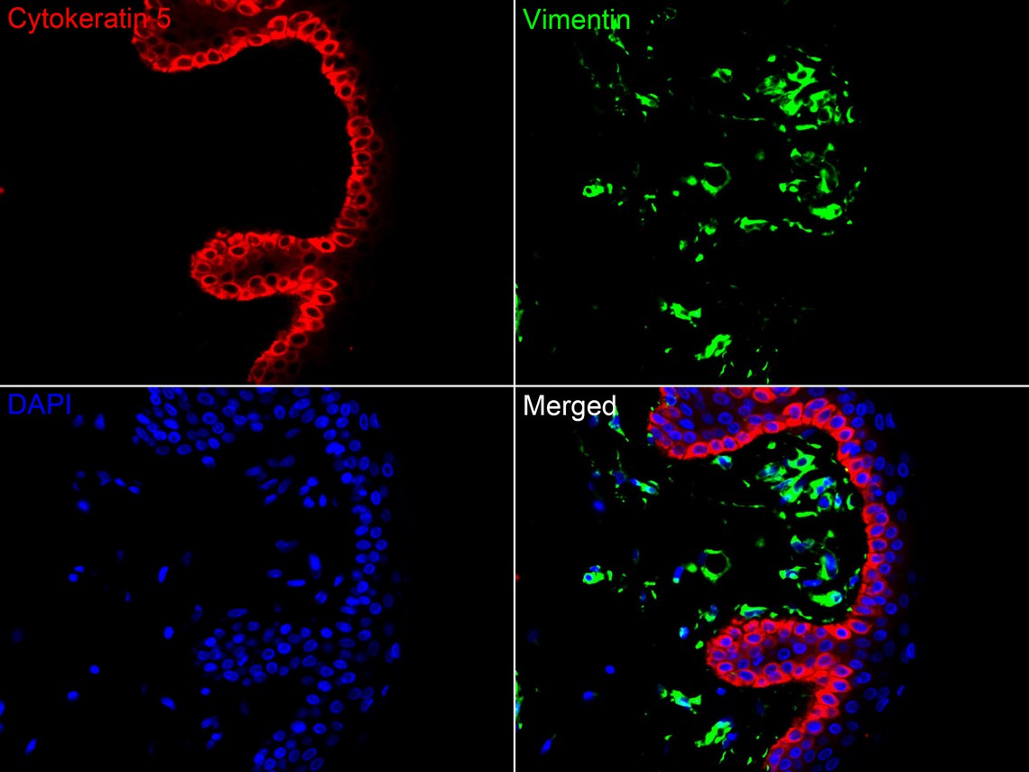Immunofluorescence analysis of paraffin-embedded human skin tissue labeling Cytokeratin 5 (HA720121F) and Vimentin (EM0401).<br />
<br />
The section was pre-treated using heat mediated antigen retrieval with Tris-EDTA buffer (pH 9.0) for 20 minutes. The tissues were blocked in 10% negative goat serum for 1 hour at room temperature, washed with PBS. And then probed with the primary antibodies Cytokeratin 5 (HA720121F, red) at 1/50 dilution and Vimentin (EM0401, green) at 1/200 dilution at +4℃ overnight, washed with PBS.<br />
<br />
Goat Anti-Mouse IgG H&L (iFluor™ 488, HA1125) were used as the secondary antibody at 1/1,000 dilution. Nuclei were counterstained with DAPI (blue).