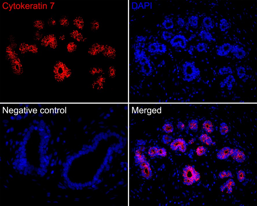 Immunofluorescence analysis of paraffin-embedded human breast tissue labeling Cytokeratin 7 (HA720120F).<br />
<br />
The section was pre-treated using heat mediated antigen retrieval with Tris-EDTA buffer (pH 9.0) for 20 minutes. The tissues were blocked in 10% negative goat serum for 1 hour at room temperature, washed with PBS. And then probed with the primary antibody Cytokeratin 7 (HA720120F, iFluor™ 594) at 1/200 dilution overnight at 4 ℃, washed with PBS. DAPI was used as nuclear counterstain.