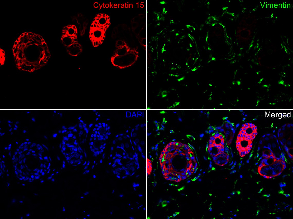 Immunofluorescence analysis of paraffin-embedded rat skin tissue labeling Cytokeratin 15 (HA720122F) and Vimentin (EM0401).<br />
<br />
The section was pre-treated using heat mediated antigen retrieval with Tris-EDTA buffer (pH 9.0) for 20 minutes. The tissues were blocked in 10% negative goat serum for 1 hour at room temperature, washed with PBS. And then probed with the primary antibodies Cytokeratin 15 (HA720122F, red) at 1/100 dilution and Vimentin (EM0401, green) at 1/400 dilution at +4℃ overnight, washed with PBS.<br />
<br />
Goat Anti-Mouse IgG H&L (iFluor™ 488, HA1125) were used as the secondary antibody at 1/1,000 dilution. Nuclei were counterstained with DAPI (blue).