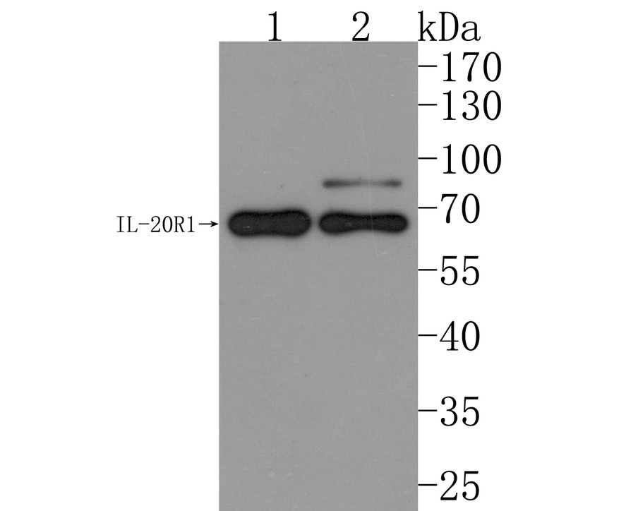 Western blot analysis of IL-20R1 on different lysates. Proteins were transferred to a PVDF membrane and blocked with 5% NFDM/TBST for 1 hour at room temperature. The primary antibody (HA500286, 1/500) was used in 5% NFDM/TBST at room temperature for 2 hours. Goat Anti-Rabbit IgG - HRP Secondary Antibody (HA1001) at 1:200,000 dilution was used for 1 hour at room temperature.<br />
Positive control: <br />
Lane 1: MCF-7 cell lysate<br />
Lane 2: SH-SY5Y cell lysate<br />
<br />
Predicted band size: 62 kDa<br />
Observed band size: 67 kDa (Glycosylation)