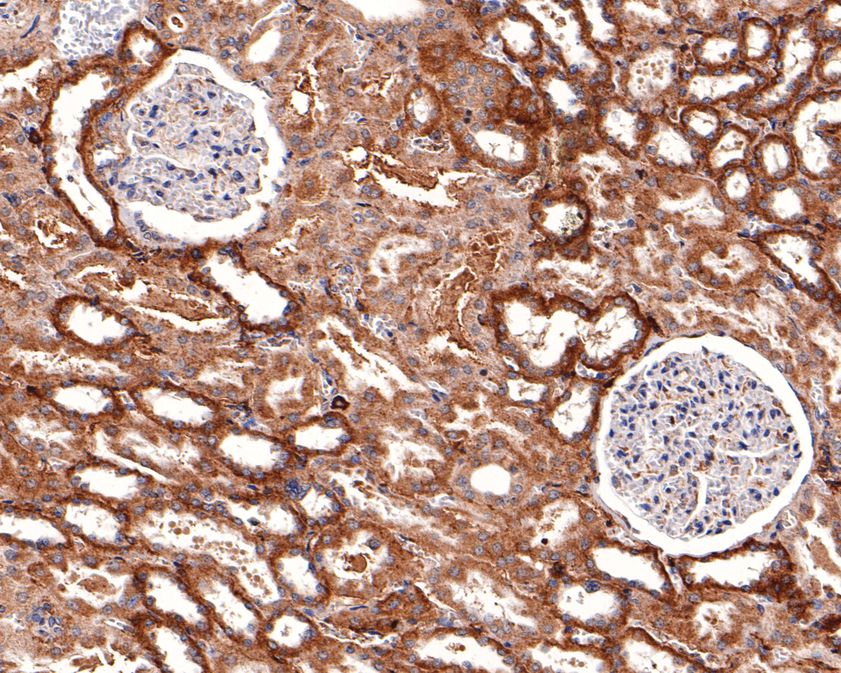 Immunohistochemical analysis of paraffin-embedded human kidney tissue using anti-IL-20R1 antibody. The section was pre-treated using heat mediated antigen retrieval with Tris-EDTA buffer (pH 9.0) for 20 minutes.The tissues were blocked in 1% BSA for 30 minutes at room temperature, washed with ddH2O and PBS, and then probed with the primary antibody (HA500286, 1/200) for 30 minutes at room temperature. The detection was performed using an HRP conjugated compact polymer system. DAB was used as the chromogen. Tissues were counterstained with hematoxylin and mounted with DPX.